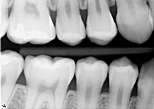 digital_imaging1